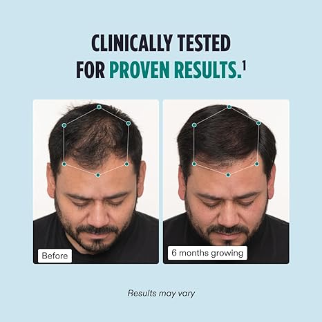 nutrafol men's hair growth supplements, clinically tested for visibly thicker hair and scalp coverage, dermatologist recommended - 1 month supply